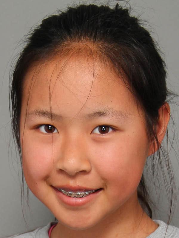 14岁女孩发明液体创可贴！获评美国顶尖科学家！网友全酸了！